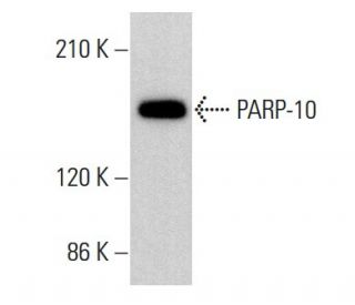 PARP-10 Antibody (5H11) - Western Blotting - Image 377416 