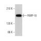 PARP-10 Antibody (5H11) - Western Blotting - Image 377416 