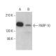 PARP-10 Antibody (5H11) - Western Blotting - Image 380184 