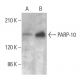 PARP-10 Antibody (6D643) - Western Blotting - Image 385278 