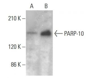 PARP-10 Antibody (6D643) - Western Blotting - Image 385278SAM Transcription Activation: SAM system utilizing dCas9-VP64, MS2-P65-HSF1, and sgRNA for precise gene transcription activation.