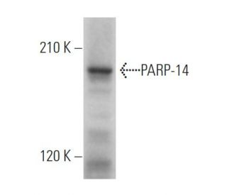 PARP-14 Antibody (C-1) - Western Blotting - Image 363936SAM Transcription Activation: SAM system utilizing dCas9-VP64, MS2-P65-HSF1, and sgRNA for precise gene transcription activation. 