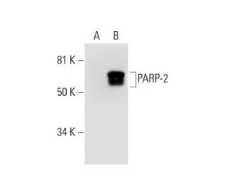 PARP-2 Antibody (F-3) - Western Blotting - Image 294551