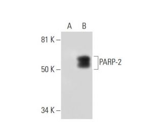 PARP-2 Antibody (F-8) - Western Blotting - Image 294796