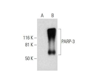 PARP-3 Antibody (C-1) - Western Blotting - Image 289818