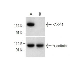 PARP-1 CRISPR/Cas9 KO Plasmid (h): sc-400046. Western blot analysis of human PARP-1 expression in empty vector control (A)