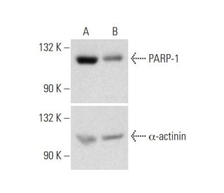 PARP-1 Double Nickase Plasmid (h2): sc-400046-NIC. Western blot analysis of PARP-1 expression in non-transfected control (