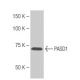 PASD1 Antibody (NB43) - Western Blotting - Image 67387 