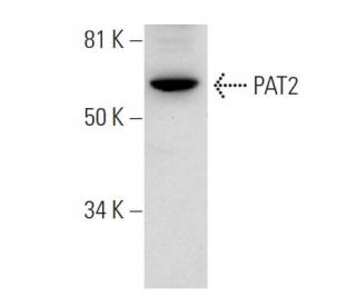 PAT2 Antibody (F-3) - Western Blotting - Image 291836 