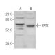 PAT2 Antibody (F-3) - Western Blotting - Image 371582