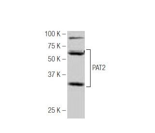 PAT2 Antibody (O-62) - Western Blotting - Image 53990