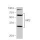 PAT2 Antibody (O-62) - Western Blotting - Image 53990
