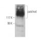 patched/PTCH1 Antibody (188G11) - Western Blotting - Image 11289