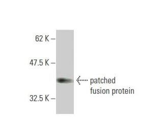 patched/PTCH1 Antibody (3B3) | SCBT - Santa Cruz Biotechnology