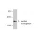 patched/PTCH1 Antibody (3B3) - Western Blotting - Image 348575