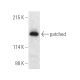 patched/PTCH1 Antibody (A-2) - Western Blotting - Image 389718