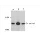 patched/PTCH1 Antibody (A-2) - Western Blotting - Image 393015 