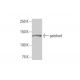 western blotting image from recommended patched/PTCH1 (3B3) monoclonal antibody replacement. Image 352131
