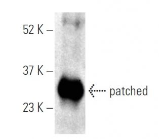 patched/PTCH1 Antibody (H-10) - Western Blotting - Image 395955 
