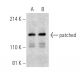 patched/PTCH1 Antibody (H-10) - Western Blotting - Image 395944