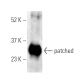 patched/PTCH1 Antibody (H-10) - Western Blotting - Image 395955 