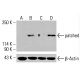 patched/PTCH1 Antibody (H-10): sc-518102. Western blot analysis of patched expression in untreated HeLa (A), chemically-treated HeLa (B), untreated K-562 (C) and chemically-treated K-562 (D) whole cell lysates. β-Actin (C4): sc-47778 used as loading control. Detection reagent used: m-IgG Fc BP-HRP: sc-525409. patched/PTCH1 Antibody (H-10) - Western Blotting - Image 416145