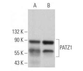 PATZ1 Antibody (D-5) - Western Blotting - Image 366873 