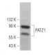 PATZ1 Antibody (H-2) - Western Blotting - Image 364512 