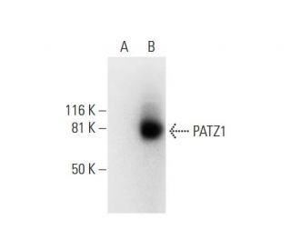 PATZ1 Antibody (H-2) - Western Blotting - Image 293041