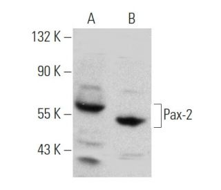 Pax-2 Antibody (60-P) - Western Blotting - Image 368215 