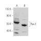 Pax-2 Antibody (60-P) - Western Blotting - Image 368215 