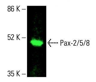 Pax-2/5/8 Antibody (G-3) - Western Blotting - Image 416231Each CRISPR/Cas9 Knockout (KO) Plasmid product consists of a pool of 3 plasmids designed to ensure identification and cleavage of a specific gene for maximum knockout efficiency. Each plasmid encodes a unique 20 nt sequence derived from the GeCKO (v2) library.