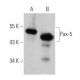 Pax-5 Antibody (1H9) - Western Blotting - Image 355314 