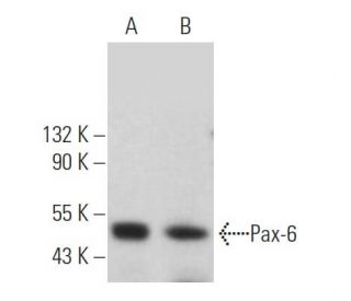 Beraadslagen kiespijn dwaas Anti-Pax-6 Antibody (AD2.38) | SCBT - Santa Cruz Biotechnology