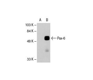 Pax-6 Antibody (PAX6) - Western Blotting - Image 18399
