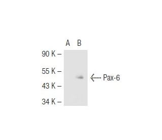 Pax-6 Antibody (PAX6) - Western Blotting - Image 45137