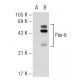 Pax-6 Antibody (PAX6) | SCBT - Santa Cruz Biotechnology