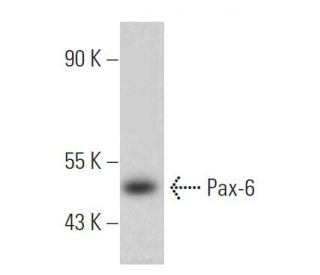 Anti-Pax-6 Antibody (PAX6) | SCBT - Santa Cruz Biotechnology