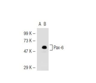Pax-6 Antibody (AD1.5) - Western Blotting - Image 45127