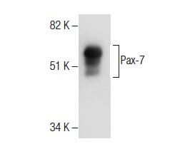 Pax Chapter 7 Pax-7抗体 (PAX7) | SCBT - Santa Cruz Biotechnology