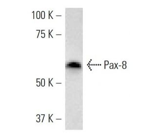 Pax-8 Antibody (PAX8R1) - Western Blotting - Image 16872