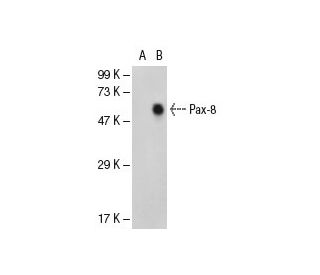 Pax-8 Antibody (PAX8R1) - Western Blotting - Image 49293Each CRISPR/Cas9 Knockout (KO) Plasmid product consists of a pool of 3 plasmids designed to ensure identification and cleavage of a specific gene for maximum knockout efficiency. Each plasmid encodes a unique 20 nt sequence derived from the GeCKO (v2) library.