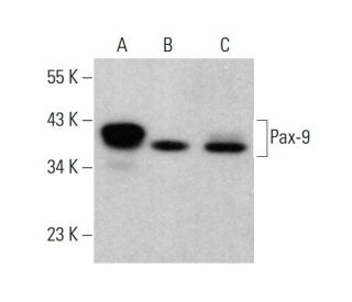 Pax-9 Antibody (7C2) - Western Blotting - Image 383121 