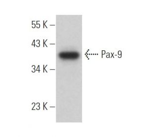 Pax-9 Antibody (7C2) - Western Blotting - Image 365622