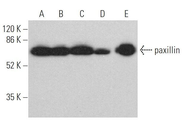 Paxillin抗体 (B-2) | SCBT - Santa Cruz Biotechnology