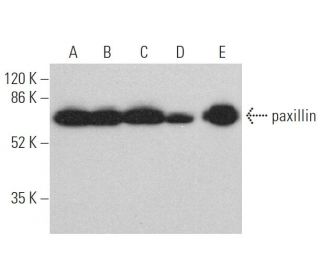 western blotting image from recommended paxillin (B-2) monoclonal antibody replacement. Image 374410