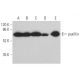 western blotting image from recommended paxillin (B-2) monoclonal antibody replacement. Image 374410