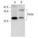 PAXX Antibody (E-4) - Western Blotting - Image 318545 