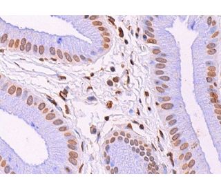 PB1 Antibody (D-8) - Immunohistochemistry - Image 374758 
