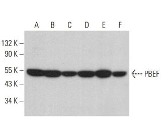 western blotting image from recommended PBEF (E-3) monoclonal antibody replacement. Image 381435